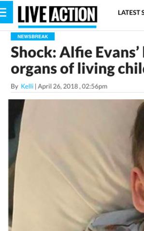 Brytyjskie media: Szpital, w którym leży Alfie Evans handlował w przeszłości organami. Przynajmniej raz sprzedał organy jeszcze żyjącego dziecka!